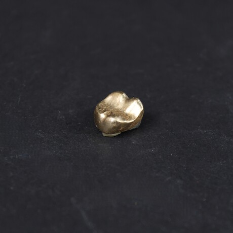 Tandguld